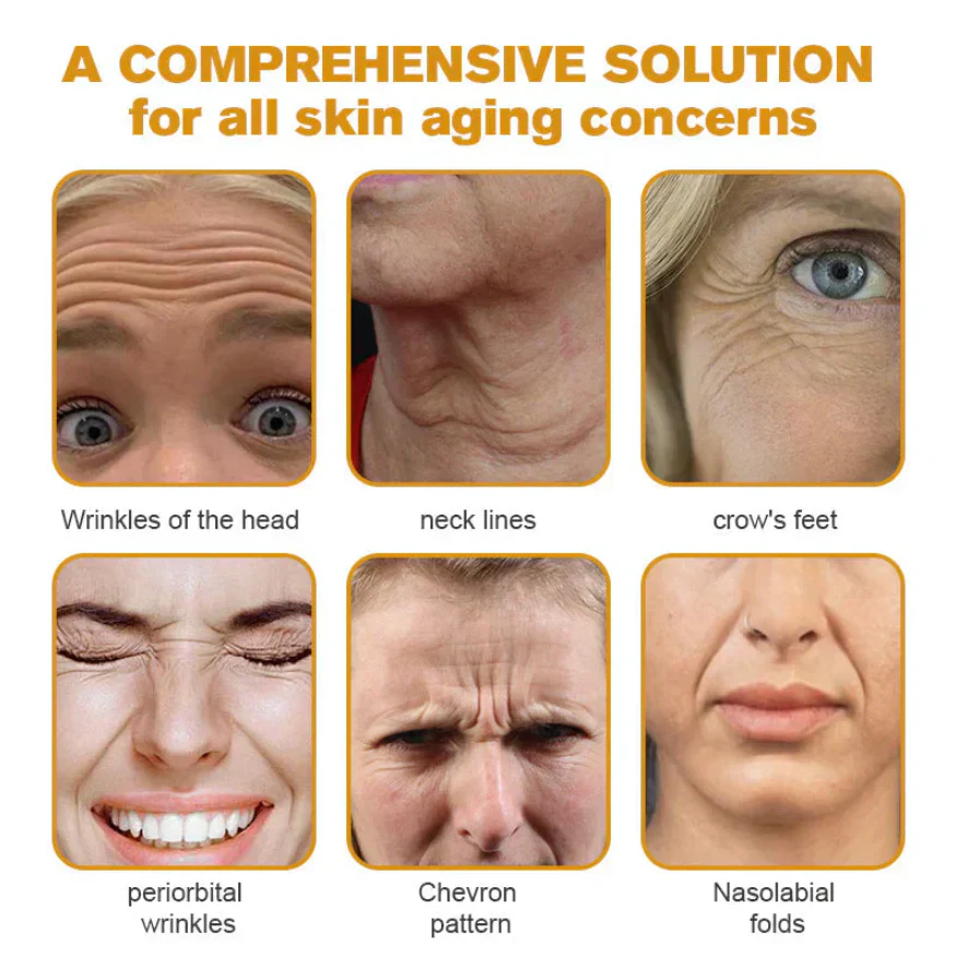 Botox Bee Venom Wrinkle Removal Cream