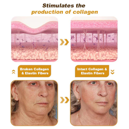 Botox Bee Venom Wrinkle Removal Cream